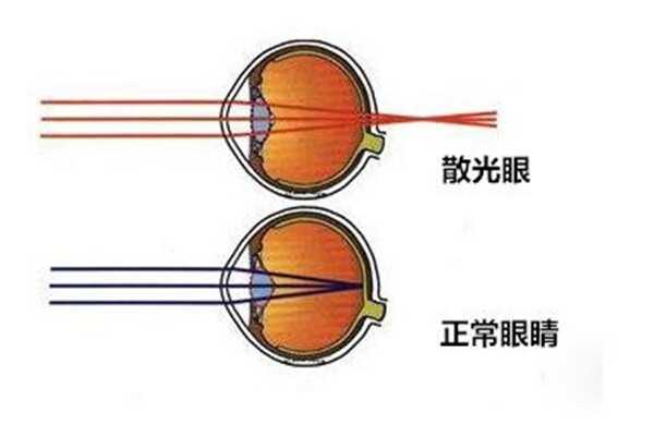 三渌蔗糖是什么 三渌蔗糖跟蔗糖一样吗(甜味剂)